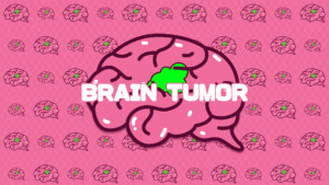 Read more about the article Brain Tumor